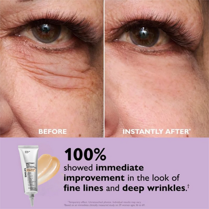 Smiles Eye Tightener