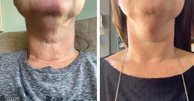 Customer photo