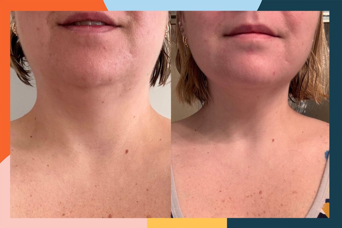 Customer photo